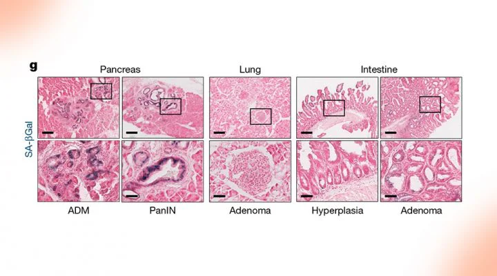 CONICET_Mouse-Cancer2-720x400