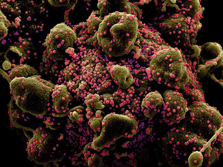 coronavirus0