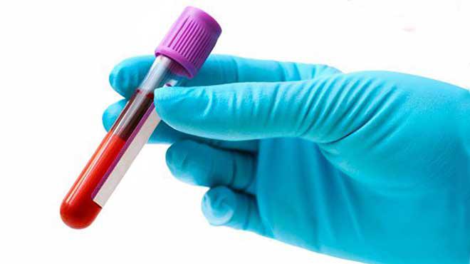 Un Nuevo Test De Sangre Permite La Detección Temprana De 50 Tipos De Cáncer 