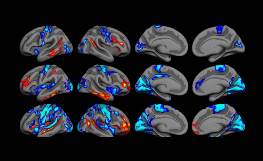 cerebro